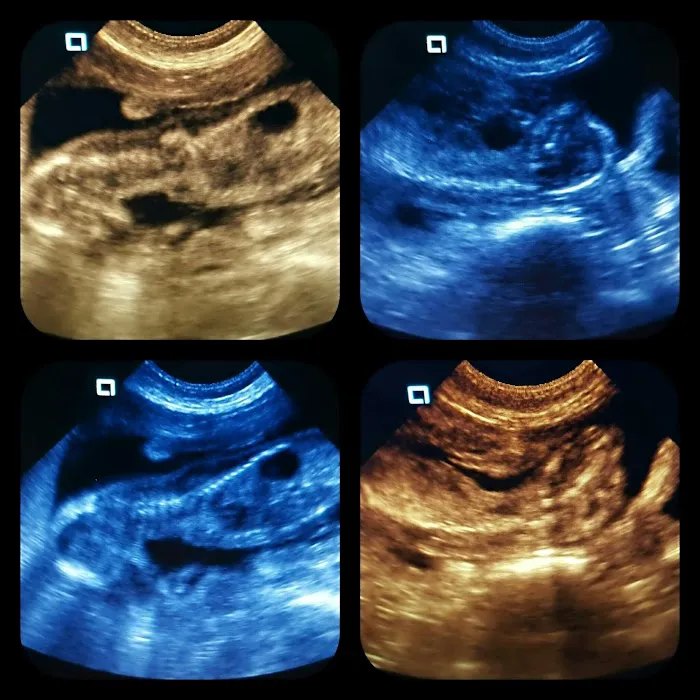 North East Pet Ultrasound Picture 2