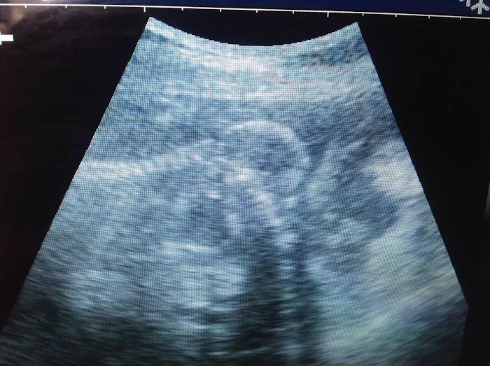 Ultrasound dog pregnancy detection Picture 3