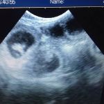 Ultrasound dog pregnancy detection