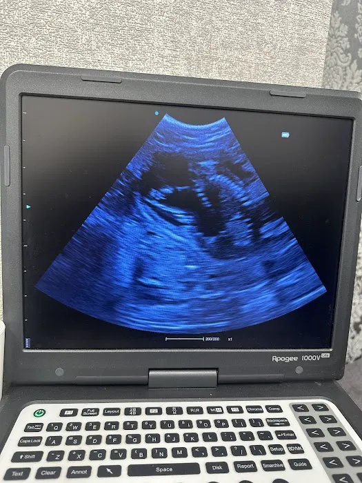 Chip and Scan Picture 1
